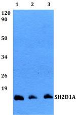 SH2D1A Polyclonal Antibody