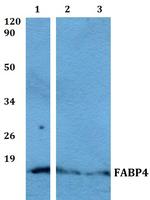 FABP4 Polyclonal Antibody