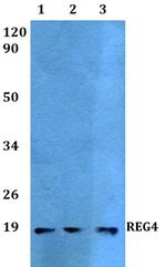 REG4 Polyclonal Antibody