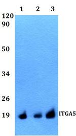 CD49e (Integrin alpha 5) Polyclonal Antibody