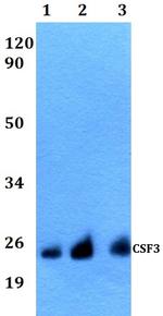 G-CSF Polyclonal Antibody