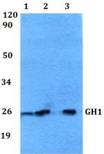 Growth Hormone Polyclonal Antibody