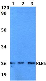 Kallikrein 6 Polyclonal Antibody