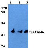 CEACAM6 Polyclonal Antibody