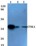 Cathepsin L Polyclonal Antibody