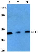 CTH Polyclonal Antibody