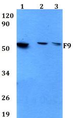 Factor IX Polyclonal Antibody