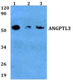 ANGPTL3 Polyclonal Antibody