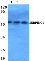 SERPINC1 Polyclonal Antibody