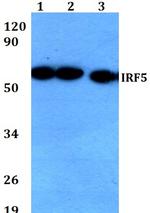 IRF5 Polyclonal Antibody