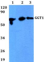GGT1 Polyclonal Antibody