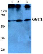 GGT1 Polyclonal Antibody