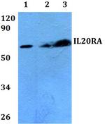 IL20RA Polyclonal Antibody