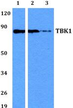TBK1 Polyclonal Antibody
