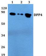 CD26 Polyclonal Antibody