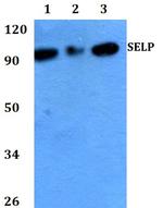 P-Selectin Polyclonal Antibody