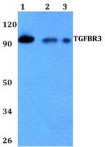 TGFBR3 Polyclonal Antibody