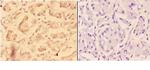 ADAM12 Polyclonal Antibody