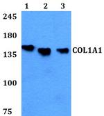 COL1A1 Polyclonal Antibody
