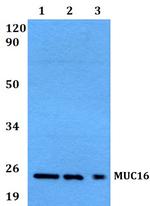 CA125 Polyclonal Antibody
