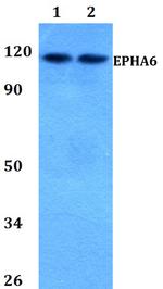 EphA6 Polyclonal Antibody