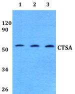 Cathepsin A Polyclonal Antibody