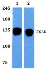 CD103 Antibody in Western Blot (WB)