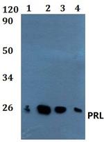 Prolactin Polyclonal Antibody