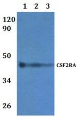 CSF2RA Polyclonal Antibody
