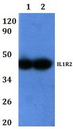 IL1R2 Polyclonal Antibody