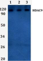 HDAC9 Polyclonal Antibody