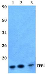 TFF1 Polyclonal Antibody