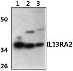 IL13RA2 Polyclonal Antibody