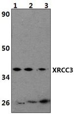 XRCC3 Antibody in Western Blot (WB)