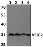VSIG2 Polyclonal Antibody