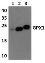 GPX1 Polyclonal Antibody