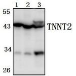 Cardiac Troponin T Polyclonal Antibody