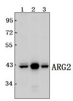 Arginase 2 Polyclonal Antibody