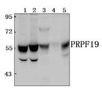 PRP19 Polyclonal Antibody