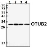 OTUB2 Polyclonal Antibody