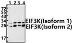 eIF3k Polyclonal Antibody