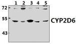 CYP2D6 Polyclonal Antibody