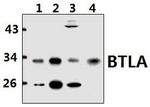 BTLA Polyclonal Antibody