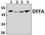 ICAD Polyclonal Antibody