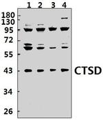 Cathepsin D Polyclonal Antibody