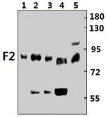 Prothrombin Polyclonal Antibody