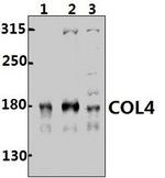 Collagen IV Polyclonal Antibody