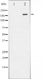 ROCK2 Polyclonal Antibody