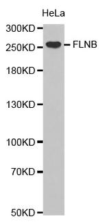 Filamin B Antibody in Western Blot (WB)