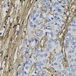 COL1A1 Antibody in Immunohistochemistry (Paraffin) (IHC (P))
